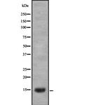 LGALS1 Antibody in Western Blot (WB)