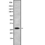 CITED2 Antibody in Western Blot (WB)