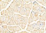 FDFT1 Antibody in Immunohistochemistry (Paraffin) (IHC (P))