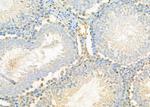 SEP15 Antibody in Immunohistochemistry (Paraffin) (IHC (P))