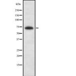 Kaiso Antibody in Western Blot (WB)