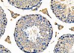 UGGT1 Antibody in Immunohistochemistry (Paraffin) (IHC (P))