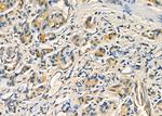 URM1 Antibody in Immunohistochemistry (Paraffin) (IHC (P))