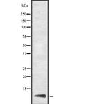 URM1 Antibody in Western Blot (WB)