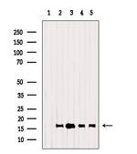 TSPO Antibody in Western Blot (WB)