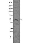 MAPKAPK2 Antibody in Western Blot (WB)