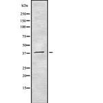 CDC123 Antibody in Western Blot (WB)