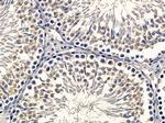 KAP3 Antibody in Immunohistochemistry (Paraffin) (IHC (P))