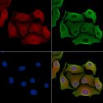 GDF3 Antibody in Immunocytochemistry (ICC/IF)