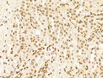 MCRS1 Antibody in Immunohistochemistry (Paraffin) (IHC (P))