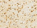 MCRS1 Antibody in Immunohistochemistry (Paraffin) (IHC (P))