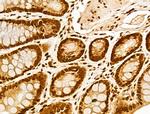 MCRS1 Antibody in Immunohistochemistry (Paraffin) (IHC (P))