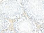 MCRS1 Antibody in Immunohistochemistry (Paraffin) (IHC (P))