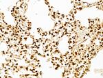 MCRS1 Antibody in Immunohistochemistry (Paraffin) (IHC (P))