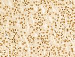 MCRS1 Antibody in Immunohistochemistry (Paraffin) (IHC (P))