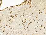 MCRS1 Antibody in Immunohistochemistry (Paraffin) (IHC (P))