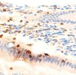 MUC2 Antibody in Immunohistochemistry (IHC)