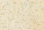 MUC2 Antibody in Immunohistochemistry (Paraffin) (IHC (P))