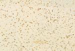 MUC2 Antibody in Immunohistochemistry (Paraffin) (IHC (P))