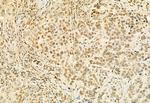 MUC2 Antibody in Immunohistochemistry (Paraffin) (IHC (P))