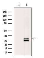 STC1 Antibody in Western Blot (WB)