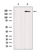 MYH2 Antibody in Western Blot (WB)