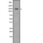 TAT Antibody in Western Blot (WB)