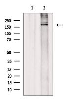 SMARCA2 Antibody in Western Blot (WB)