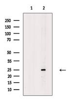 Cathepsin H Antibody in Western Blot (WB)