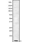 beta-2 Defensin Antibody in Western Blot (WB)