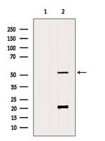 FUT4 Antibody in Western Blot (WB)