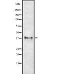 HLA-G Antibody in Western Blot (WB)