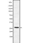 HOXB4 Antibody in Western Blot (WB)