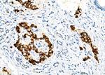 KCNMA1 Antibody in Immunohistochemistry (Paraffin) (IHC (P))