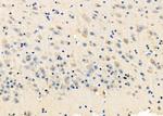 NMDAR2C Antibody in Immunohistochemistry (Paraffin) (IHC (P))