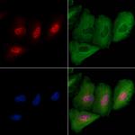 RAP1 Antibody in Immunocytochemistry (ICC/IF)