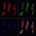 RBMS3 Antibody in Immunocytochemistry (ICC/IF)