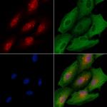 RFC3 Antibody in Immunocytochemistry (ICC/IF)