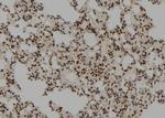 RFC3 Antibody in Immunohistochemistry (Paraffin) (IHC (P))