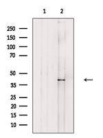 RFC3 Antibody in Western Blot (WB)