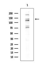 Drosha Antibody in Western Blot (WB)