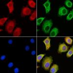 SEMA3C Antibody in Immunocytochemistry (ICC/IF)