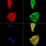 STEAP1 Antibody in Immunocytochemistry (ICC/IF)