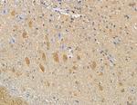 STEAP1 Antibody in Immunohistochemistry (Paraffin) (IHC (P))