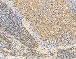 STEAP1 Antibody in Immunohistochemistry (Paraffin) (IHC (P))