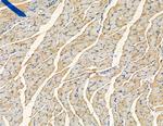 STEAP1 Antibody in Immunohistochemistry (Paraffin) (IHC (P))