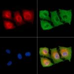 TENC1 Antibody in Immunocytochemistry (ICC/IF)