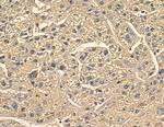 TENC1 Antibody in Immunohistochemistry (Paraffin) (IHC (P))