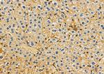 TENC1 Antibody in Immunohistochemistry (Paraffin) (IHC (P))