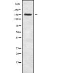 TENC1 Antibody in Western Blot (WB)